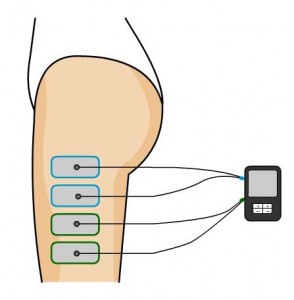 cintilla electroestimulacio