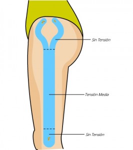 Cintilla Kinesiotape